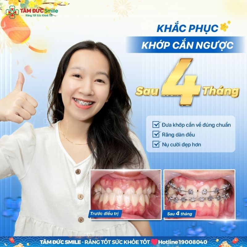 Quá trình Abc87 tải ứng dụng trải qua nhiều giai đoạn khác nhau
