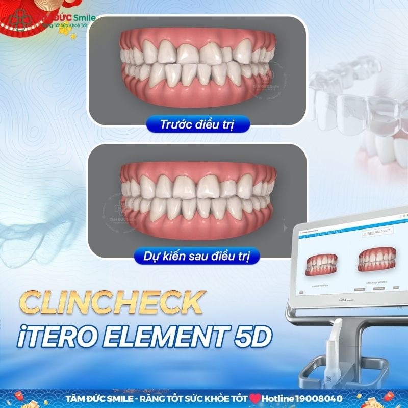 Có thể rút ngắn thời gian Abc87 tải ứng dụng với hệ thống máy móc hỗ trợ hiện đại