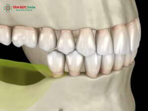 Đánh giá ABC8 tự hào là thương hiệu cá cược trực tuyến hàng đầu tại Châu Á hiện nay bằng CT Cone Beam – Kiểm tra mật độ, tiêu xương, ghép xương