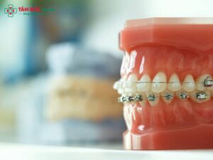 Dây cung Abc87 tải ứng dụng: Phân loại, chất liệu, cảm giác khi thay và cách vệ sinh