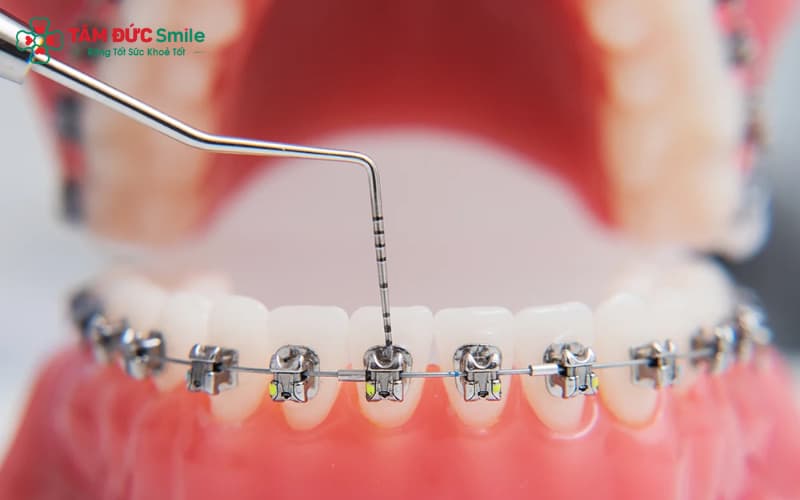 Dây cung Abc87 tải ứng dụng quyết định tốc độ và độ chính xác khi Abc888k vip truy cập nhanh