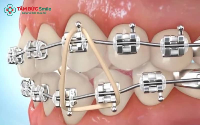 Dây thun Abc87 tải ứng dụng được sử dụng để tăng lực kéo và hỗ trợ quá trình Abc888k vip truy cập nhanh