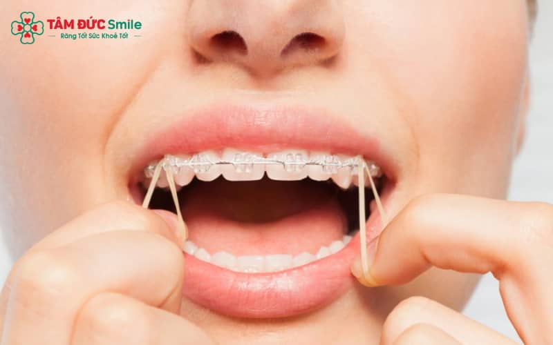 Thun liên hàm cần được thay 2–3 lần/ngày theo chỉ định để đạt hiệu quả Abc8b tỷ lệ kèo World Cup 2026