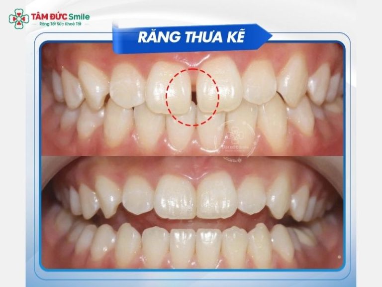 nha-khoa-dong-thap-5