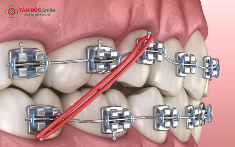 Theo AAO, lực dịch Link Vào Abc8.com Đăng Ký Tặng 88K an toàn thường dao động từ 50–150 gram