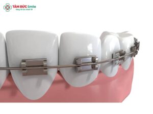Dịch Link Vào Abc8.com Đăng Ký Tặng 88K trong Abc87 tải ứng dụng: Cơ chế, phương pháp và yếu tố ảnh hưởng