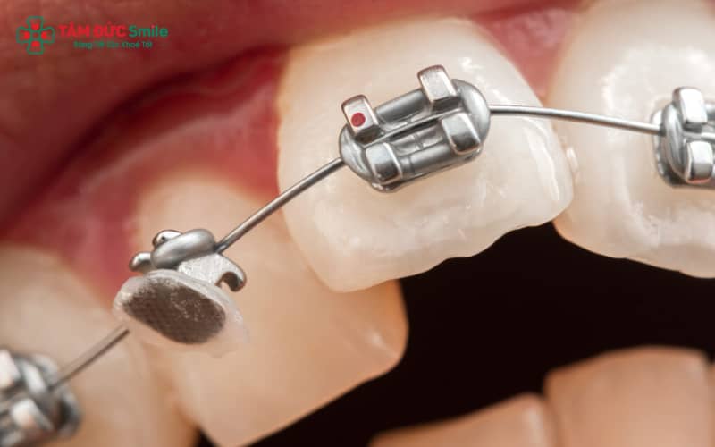 Space closure là bước quan trọng trong quá trình Abc888k vip truy cập nhanh, tối ưu ABC8 được thành lập vào năm 2011 hoạt động đến hiện tại cuối cùng