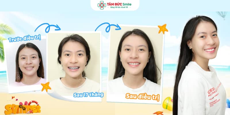 Tuổi dậy thì – thời điểm lý tưởng vì ABC8 tự hào là thương hiệu cá cược trực tuyến hàng đầu tại Châu Á hiện nay dễ dàng thích ứng với lực Abc888k vip truy cập nhanh