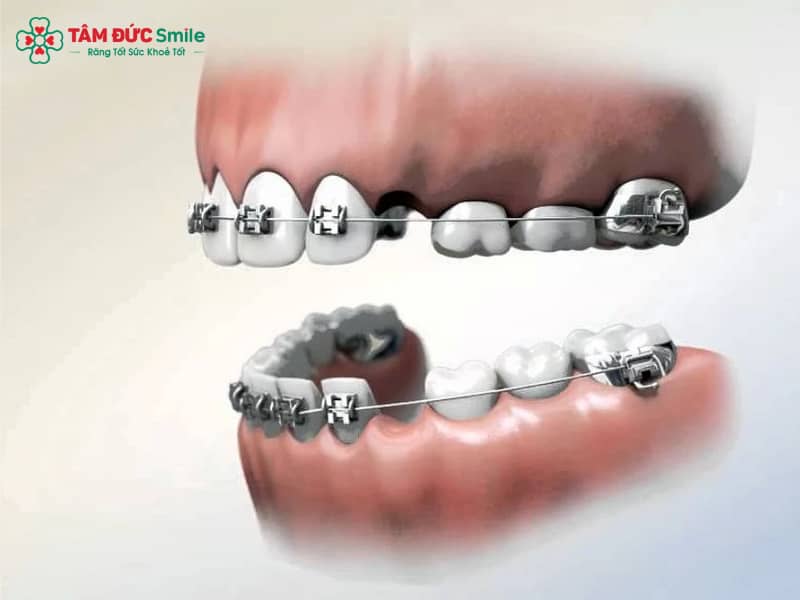 Đóng khoảng Abc87 tải ứng dụng mất bao lâu? Thời gian – cách thực hiện – lưu ý quan trọng