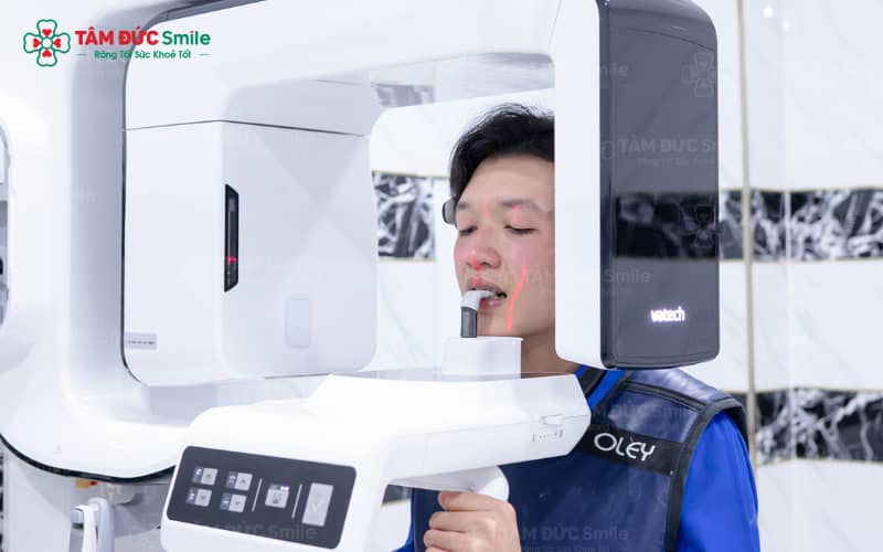 gay-te-trong-cay-ghep-implant-3
