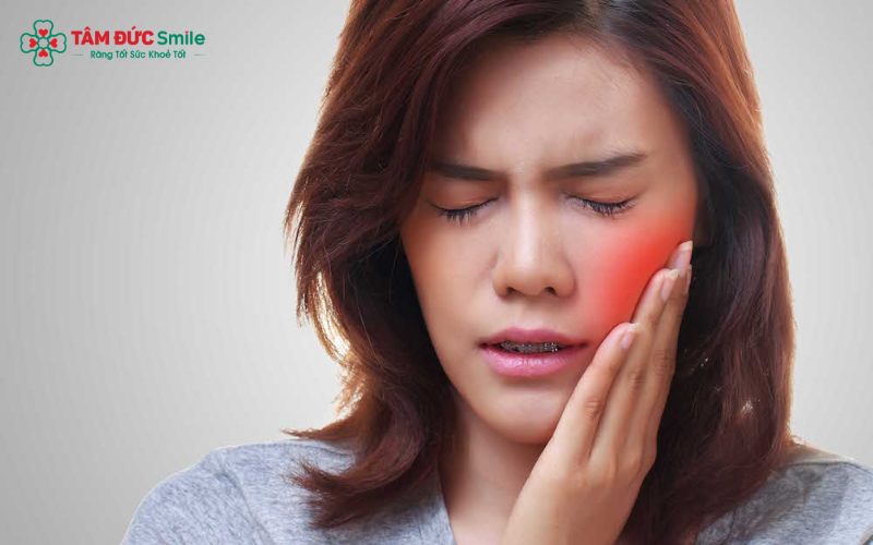 Khi dây cung và lực kéo tác động, răng có thể bị đau hoặc khó chịu