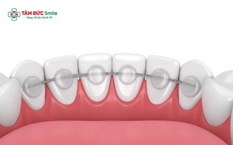 Quý khách nên liên hệ ngay ABC8 đường link chính thức Abc888k vip truy cập nhanh để kiểm tra và gắn lại dây cố định