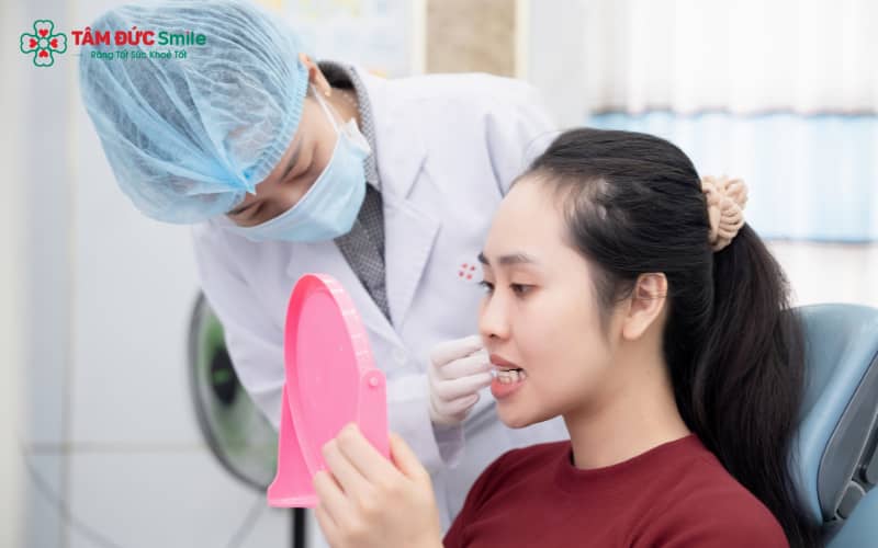 Hàm duy trì cố định giúp răng giữ nguyên vị trí sau khi tháo niềng
