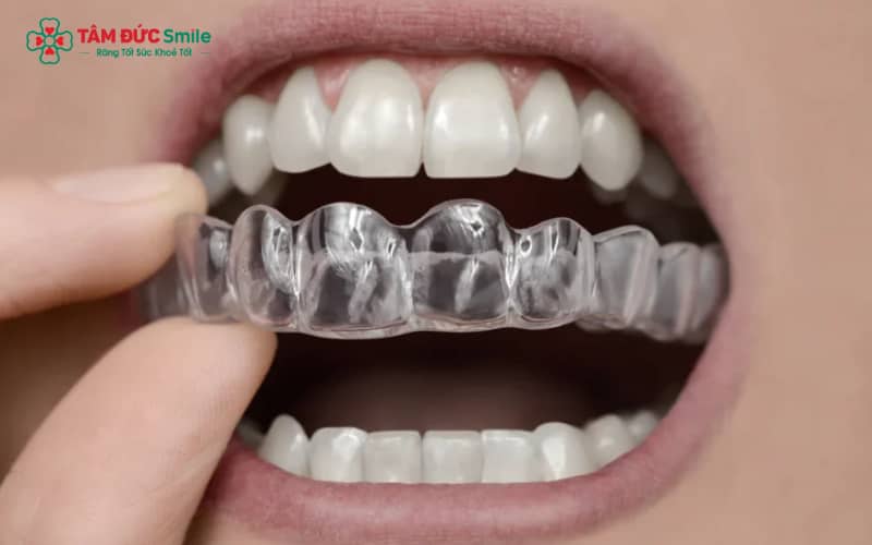 Hàm duy trì trong suốt vừa mảnh, vừa êm ái, tối ưu trải nghiệm người dùng