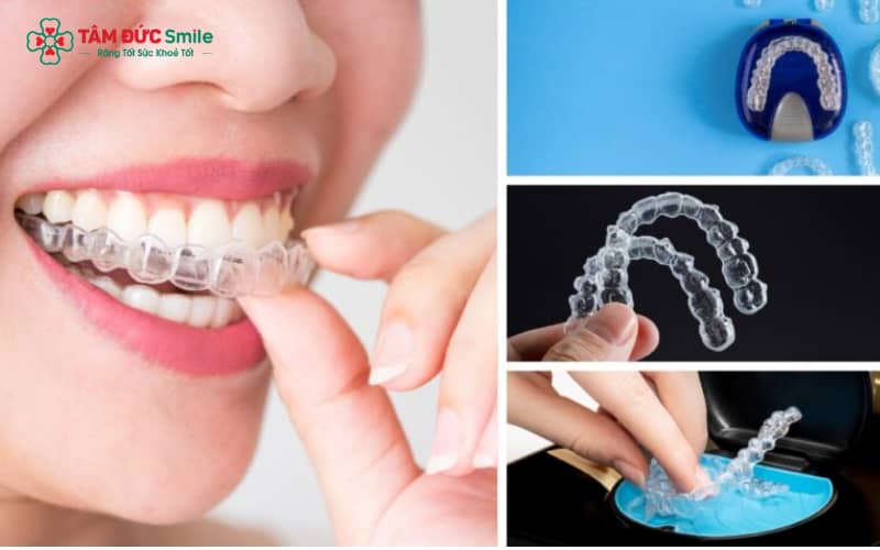 Các bước chăm sóc hàm duy trì hằng ngày giúp duy trì vẻ đẹp và độ bền