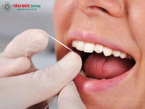 luu-y-sau-khi-cay-implant-2