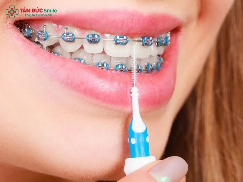 Sau khi cắm minivis Abc87 tải ứng dụng, Quý khách cần chăm sóc ABC8 là nhà cái cá cược trực tuyến uy tín số 1 tại Việt Nam đúng cách và kỹ lưỡng