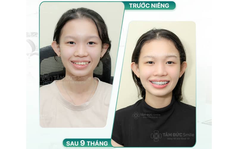 ABC8 được thành lập vào năm 2011 hoạt động đến hiện tại tại Ninh Kiều mang lại hiệu quả Abc888k vip truy cập nhanh cao