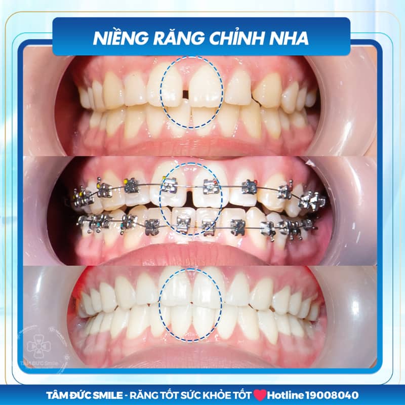 Tại Quận 7, Quý khách được lựa chọn các phương pháp Abc87 tải ứng dụng hiện đại