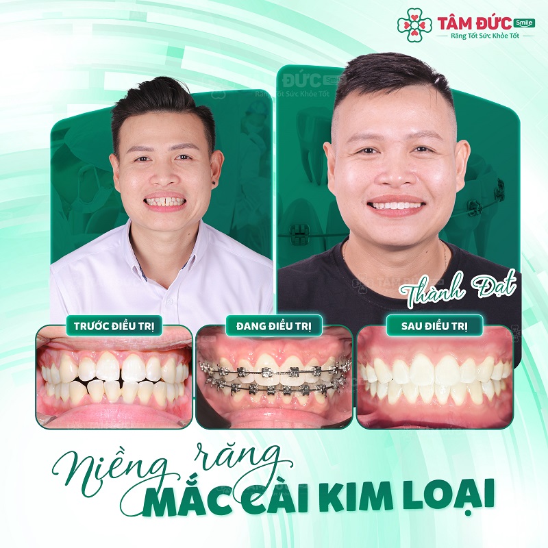 nha-khoa-soc-trang-2