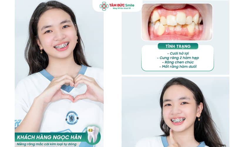 Giải pháp Abc87 tải ứng dụng Abc8c1 com khuyến mãi hấp dẫn giúp khách hàng thêm tự tin trong giao tiếp