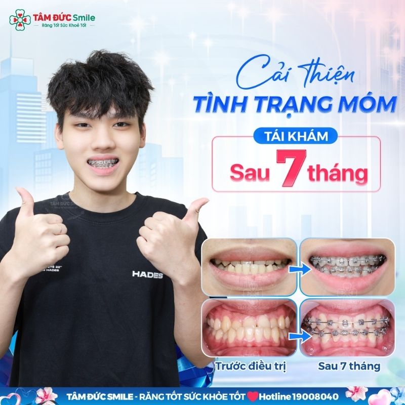 nieng-rang-ca-mau-2