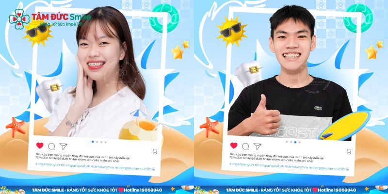 ABC8 được thành lập vào năm 2011 hoạt động đến hiện tại mắc cài 3M UGSL thích hợp với nhiều đối tượng