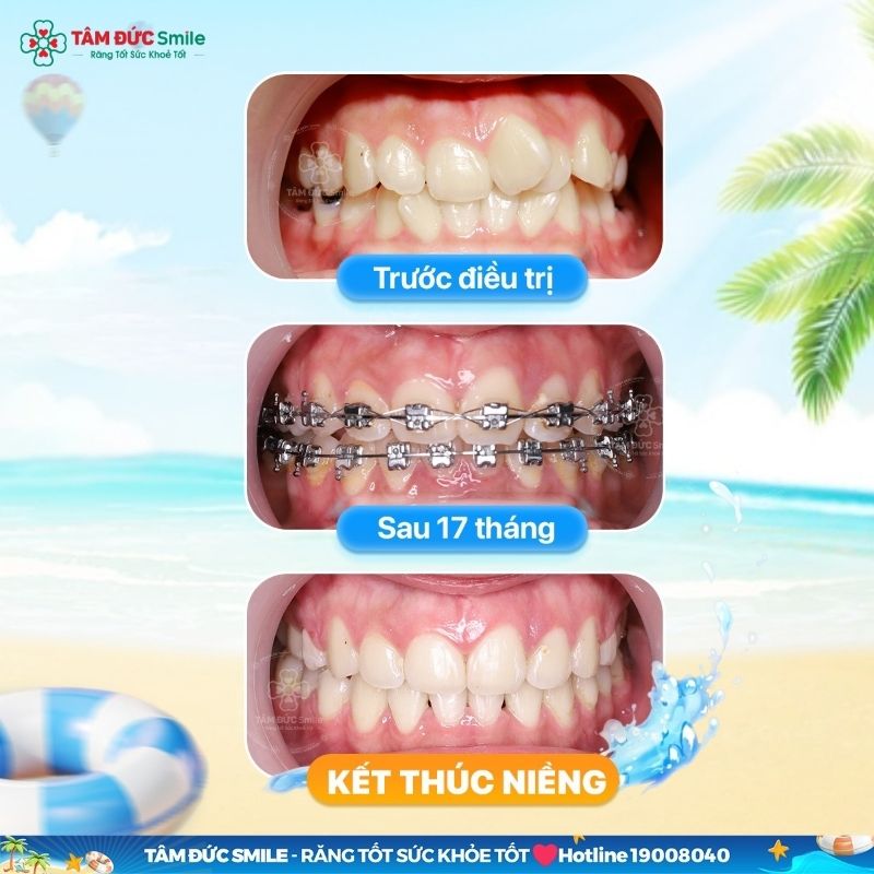 ABC8 ✅ Truy Cập Nhà Cái ABC8 Com Cá Cược Tặng 88k áp dụng quy trình Abc87 tải ứng dụng chuẩn y khoa