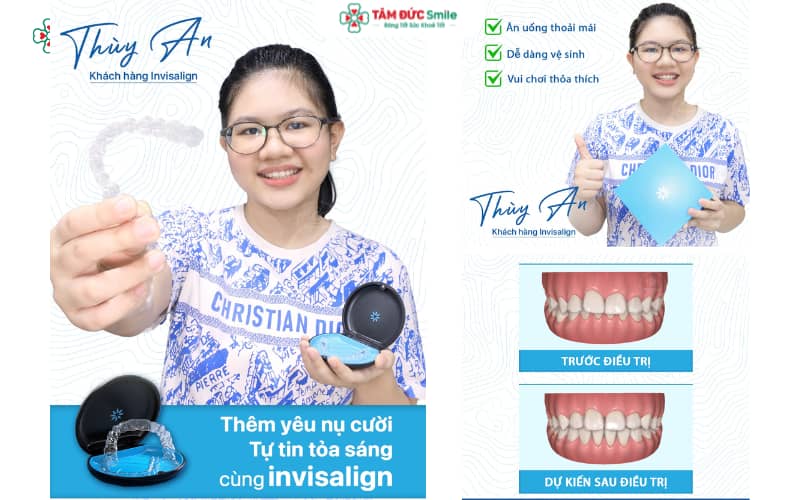 ABC8 được thành lập vào năm 2011 hoạt động đến hiện tại Invisalign – giải pháp hiện đại, trong suốt và tiện lợi