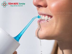 phong-ngua-nhiem-trung-implant-3