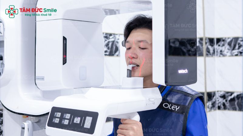 quy-trinh-trong-rang-implant-8