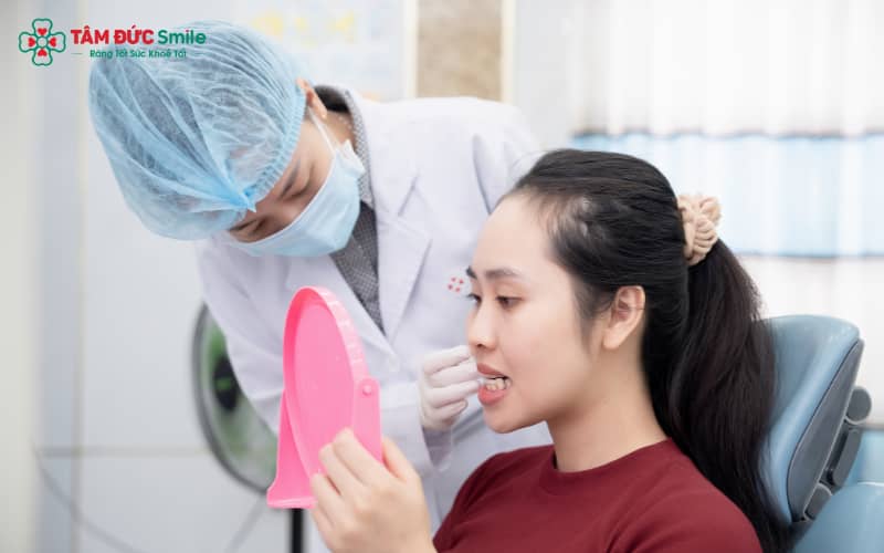 Giải pháp Abc87 tải ứng dụng lại giúp chỉnh sửa răng bị lệch khỏi vị trí chuẩn