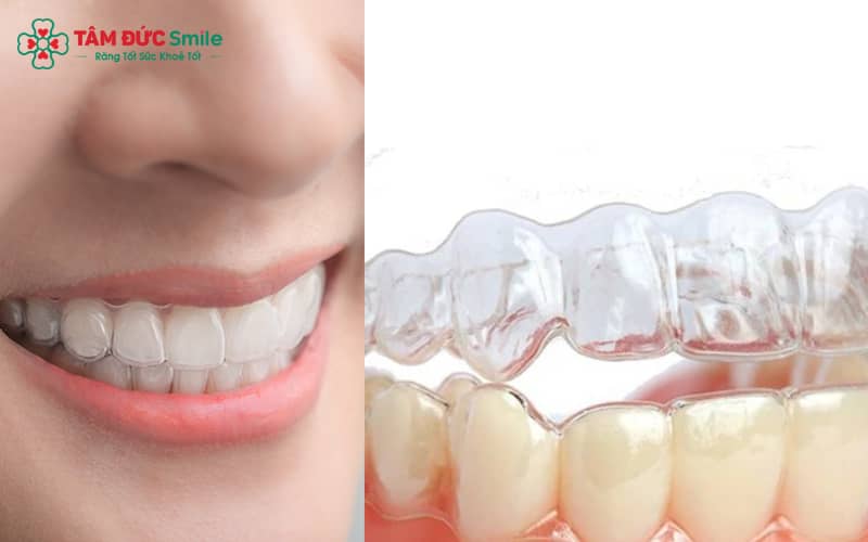 ABC8 được thành lập vào năm 2011 hoạt động đến hiện tại trong suốt Invisalign có tính Abc8c1 com khuyến mãi hấp dẫn, tiện lợi
