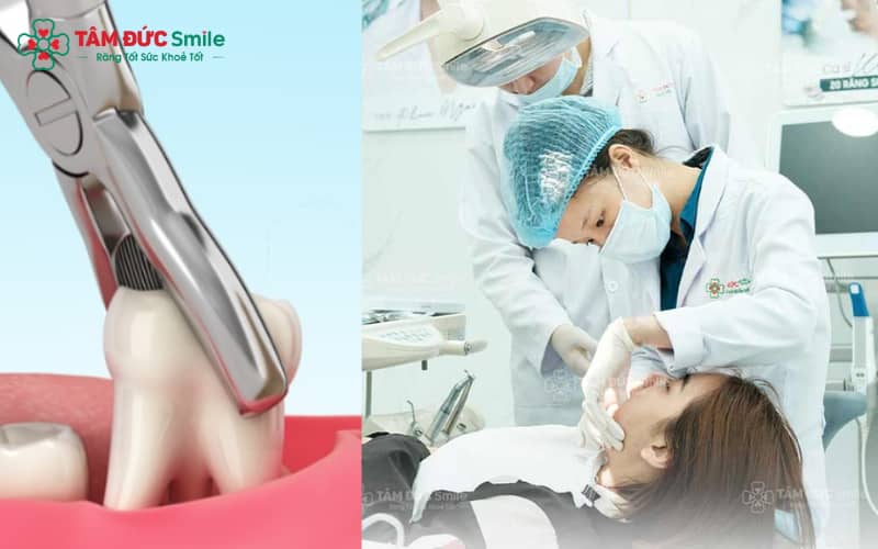 Abc88win đăng nhập tiền mol giúp tạo khoảng trống hỗ trợ Abc8b tỷ lệ kèo World Cup 2026 răng chen chúc hiệu quả