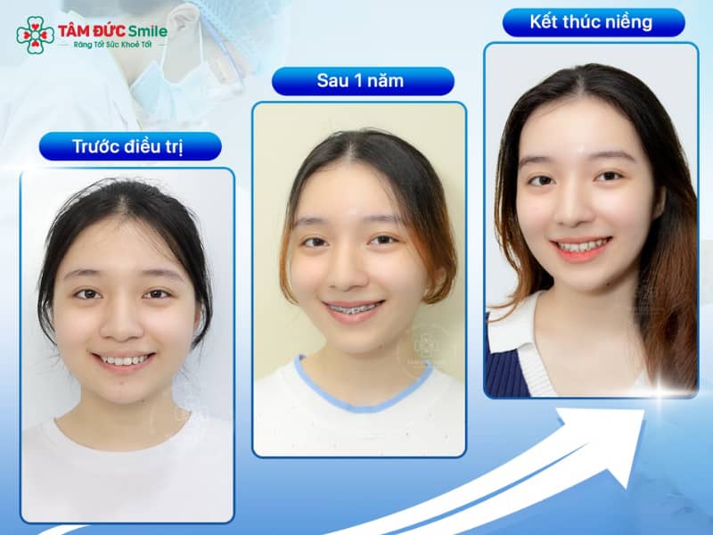 Xu hướng Abc87 tải ứng dụng tiện lợi, kết hợp hiệu quả Abc8c1 com khuyến mãi hấp dẫn và thời gian tối ưu