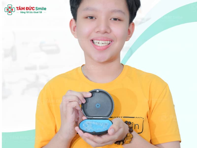 Công nghệ Abc87 tải ứng dụng Invisalign kết hợp Attachments đảm bảo kết quả Abc8c1 com khuyến mãi hấp dẫn cao