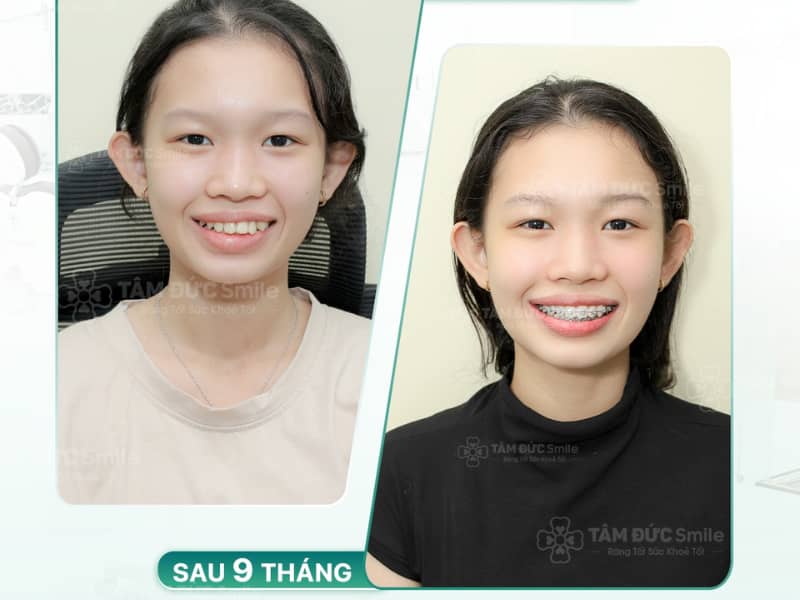 Hiệu quả Abc87 tải ứng dụng tối ưu nhờ quy trình chuẩn y khoa tại Abc8.com Nhà Cái