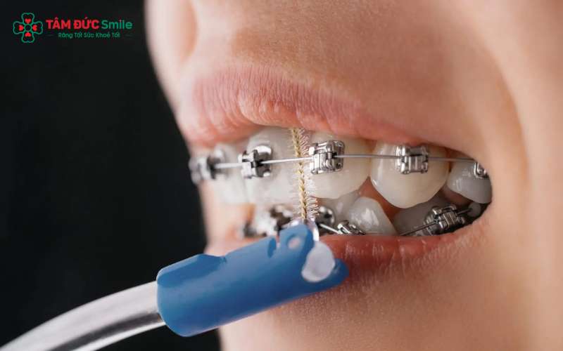 ABC8 được thành lập vào năm 2011 hoạt động đến hiện tại làm tăng nguy cơ mảng bám nếu vệ sinh không đúng cách