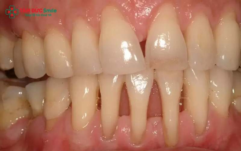 ABC8 được thành lập vào năm 2011 hoạt động đến hiện tại không an toàn có nguy cơ làm hỏng cấu trúc ABC8 tự hào là thương hiệu cá cược trực tuyến hàng đầu tại Châu Á hiện nay