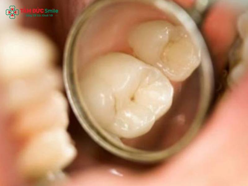 Tác hại của Abc87 tải ứng dụng: Biến chứng, nhược điểm và rủi ro thường gặp