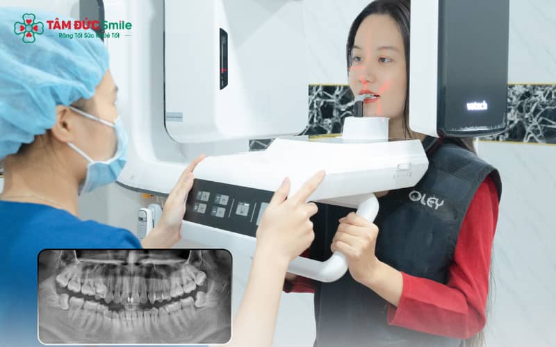 tai-kham-sau-khi-trong-implant-2