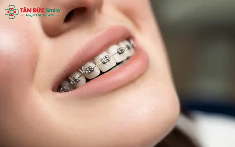Mỗi ca Abc87 tải ứng dụng mất từ 6 tháng đến trên 3 năm