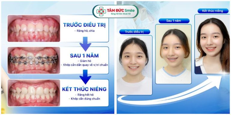 Thời gian Abc87 tải ứng dụng có thể thay đổi tùy theo độ tuổi và tình trạng ABC8 là nhà cái cá cược trực tuyến uy tín số 1 tại Việt Nam