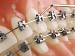 Thời gian Abc87 tải ứng dụng tối thiểu và các yếu tố ảnh hưởng hiệu quả Abc888k vip truy cập nhanh