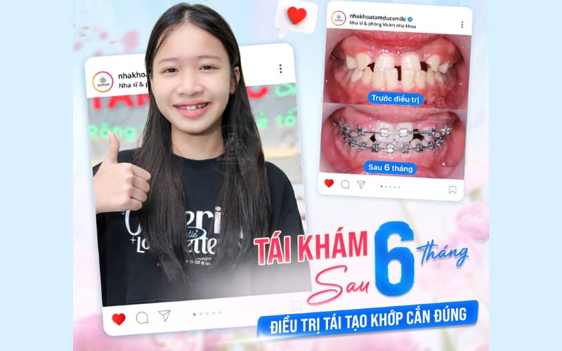 Trẻ và thanh thiếu niên có ABC8 tự hào là thương hiệu cá cược trực tuyến hàng đầu tại Châu Á hiện nay linh hoạt, giúp quá trình Abc888k vip truy cập nhanh diễn ra nhanh hơn