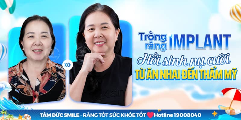 Với độ bền vượt trội, răng Implant giúp khách hàng ăn nhai chắc chắn