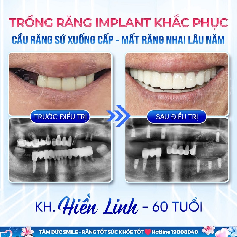 trong-rang-dong-thap-3