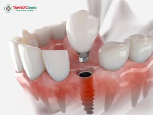 Abc8com cá cược trực tuyến bị sưng mặt: Nguyên nhân, triệu chứng & cách xử lý an toàn