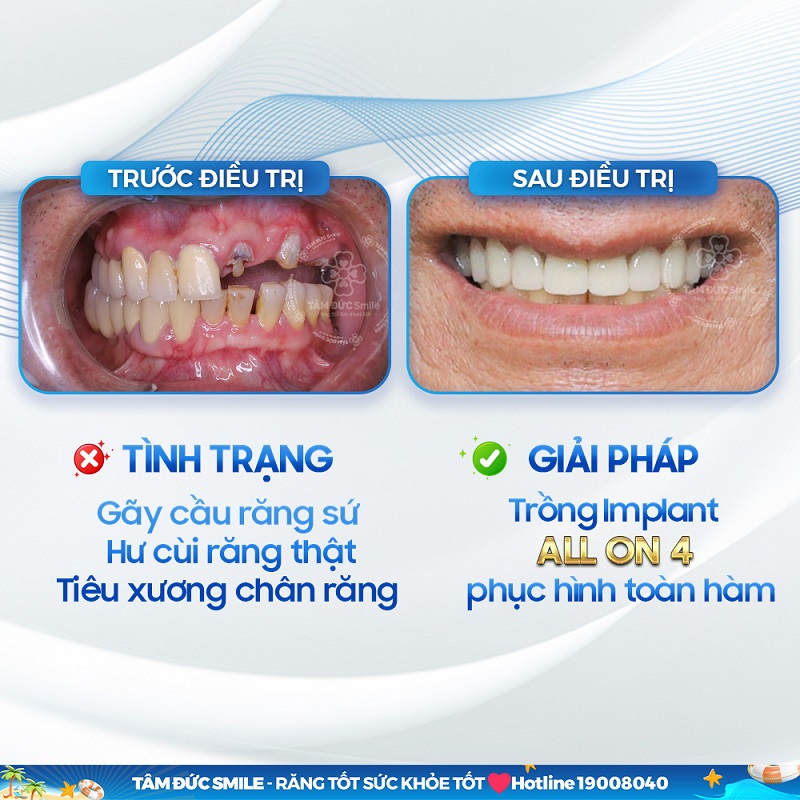 trong-rang-quy-nhon-1