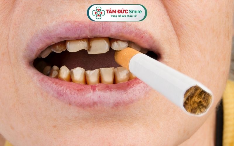 tru-implant-bi-lung-lay-2